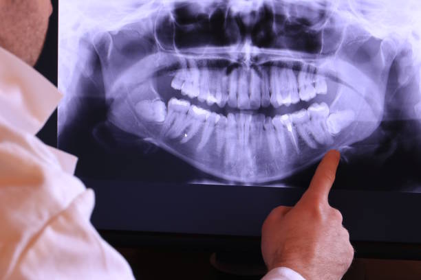 Best Emergency Tooth Extraction in Murphys Estates, SC